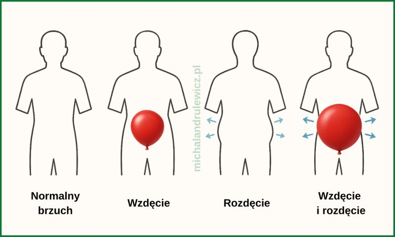 Interpretacja wyników SIBO